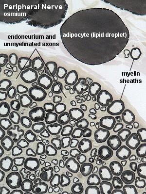 CÉLULAS DE SUSTENTAÇÃO DO SISTEMA NERVOSO PERIFÉRICO Células de Schwann Nervo Periférico Ósmio endonuero e axônios amielínicos Célula adiposa (lipídio) Bainha de mielina A mielina é formada pela