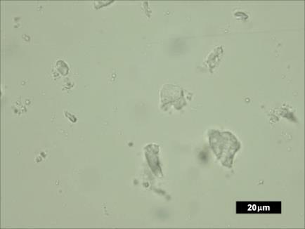 Microcápsulas de óleo de palma obtidas por coacervação complexa em matriz de gelatina e goma arábica apresentaram diâmetro médio maior, variando de 97,1 a 689,1 µm (Marfil, 2014).
