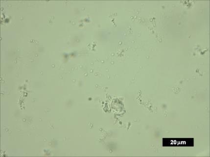 Na Figura 1 encontra-se as imagens de microscopia ótica das micropartículas de quitosana contendo óleo de palma.