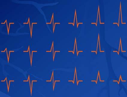 ECG NORMAL V 1 V 2 V 3 V 4 V 5