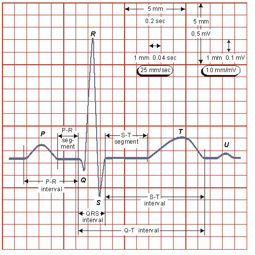 ECG NORMAL Crianças