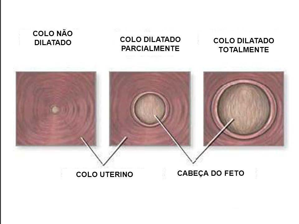 FASES DO TRABALHO DE PARTO 1ª Fase - Dilatação: abertura do colo uterino, formando um só canal,