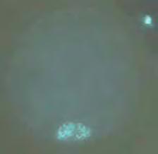 A B C Figura 6 - Fotomicrografia de oócitos caninos corados