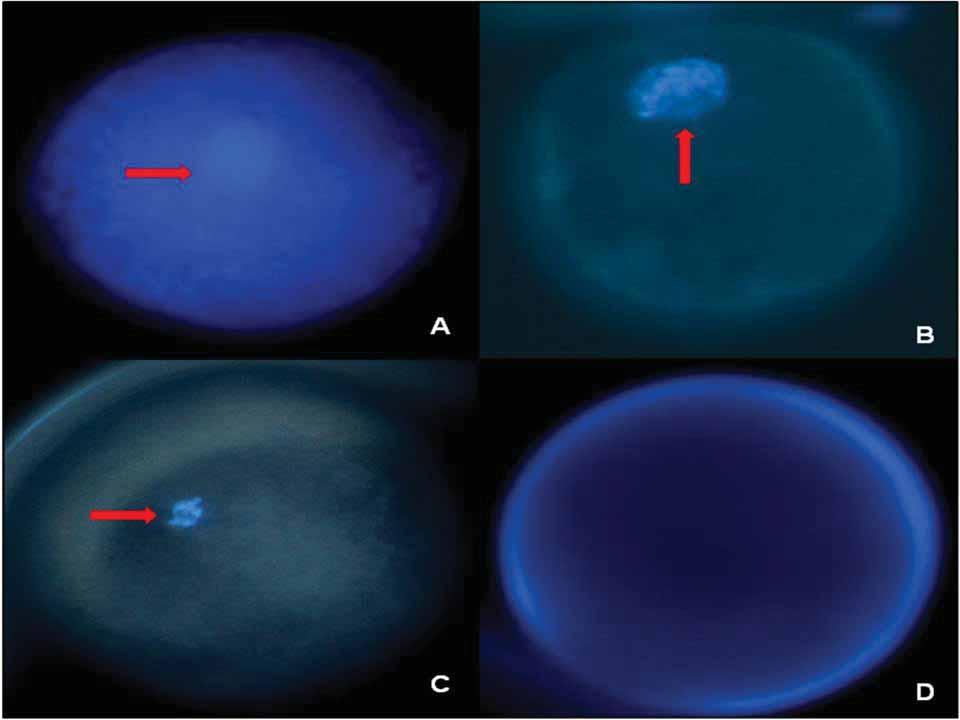 Figura 7 - Fotomicrografia de oócitos caninos corados pela técnica de fluorescência (DAPI) onde nas setas vermelhas são