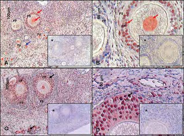 Figura 25 Fotomicrografia de cortes histológicos de ovários de cadelas, demonstrando a imunolocalização do fator de crescimento semelhante à insulina -1 (IGF-1) nas células foliculares de folículos