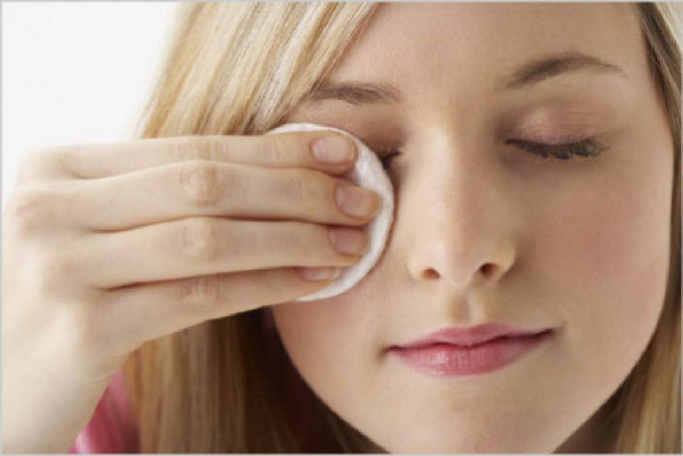 A importância da higiene ocular A blefarite ocorre quando pequenas glândulas sebáceas localizadas perto da base dos cílios não funcionam corretamente.
