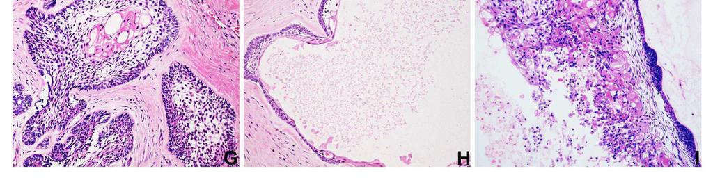 plexiforme tecido conjuntivo fibroso.