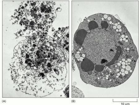 Apoptose Necrose Apoptose Apoptose é uma morte celular programada, mediada por uma cascata de sinalização que faz