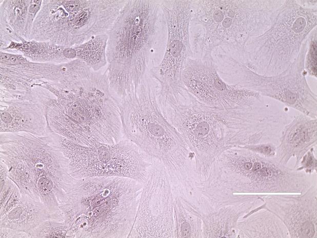 A deposição de cálcio, sugestiva de diferenciação em osteócito, foi confirmada pela coloração com Alizarin Red (2% p/v), ficando assim os osteócitos e matriz extracelular contendo depósito de cálcio