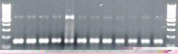 indicando ausência de inibidores da reação de PCR (Fig. 1).