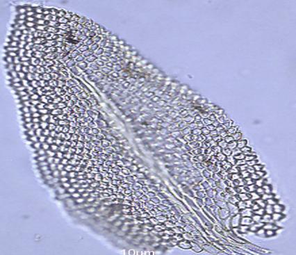 papilosa com as papilas dispostas na periferia da célula. Seta lisa, 1-2cm compr. Cápsula inclinada, curto-cilíndrica, 0,6-1,4mm compr.