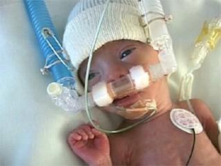 Asfixia e Depressão Causas da Depressão ao Nascimento Ao nascer, os neonatos são em geral vigorosos e, quase que imediatamente após o clampeamento do cordão, iniciam a respiração espontânea, chorando.
