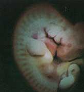 Segunda Semana Na segunda semana, depois da Nidação, a cavidade uterina se especializa com o objetivo de proteger e nutrir o futuro feto. Cresce o mesoderma e vasos sanguíneos.