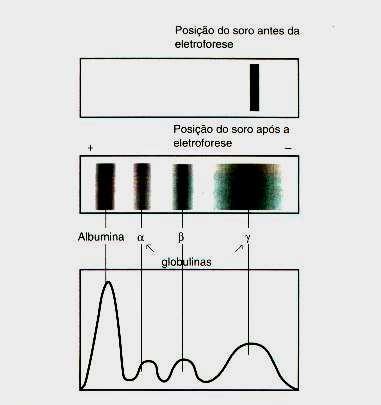 O Sistema Complemento é composto por proteínas plasmáticas / séricas pertencentes às frações gama, beta e alfa globulinas por causa do