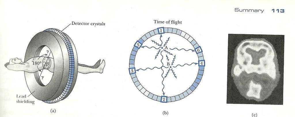 A aniquilação de um par à serviço da saúde humana: PET (Positron Emissor Tomography) Fig. Modern Physics for Scientists and Engineers S. Thornton, A.