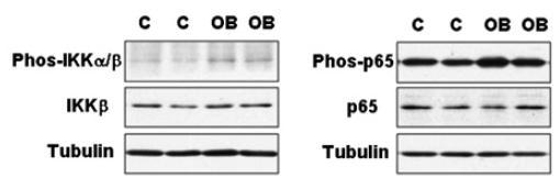 RESULTADOS E DISCUSSÃO Phos-IkB kinase α/β (Ser 176/180)