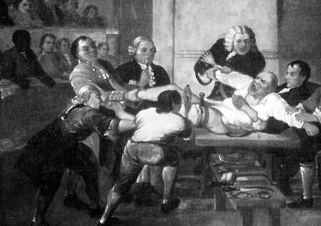 Controle da dor Até meados do século XIX, os procedimentos cirúrgicos realizados foram os de emergência.