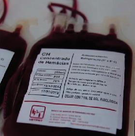 PLASMA FRESCO CONGELADO - (4 UNIDADES) 60,00 CADA Os hemocomponentes e suas indicações Sangue