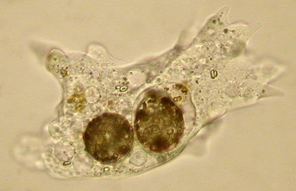 Parasita intracelular de amebas: Acanthamoeba