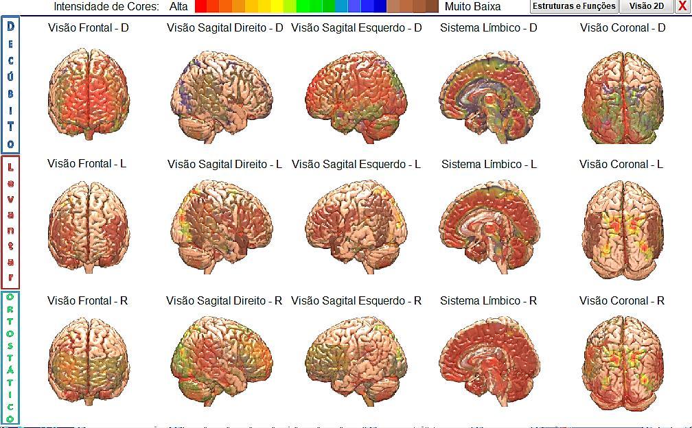 Interpretação do Cérebro Emocional e o Cérebro Racional, A análise mostrou que o cérebro apresentou alta atividade durante o DLO nas três posições.