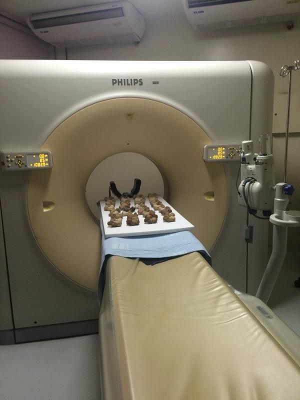 34 Figura 12 Calcâneos sendo tomografados. Fonte: Foto do presente trabalho. Departamento de Radiologia, HUAP, 2016. 4.