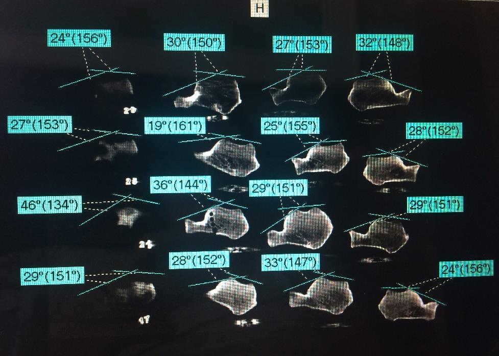 37 Figura 16 Cada linha traçada em um plano - Software PAX. Fonte: Foto do presente trabalho. Departamento de Radiologia, HUAP, 2016. 4.