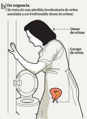 18 Incontinência Urinária de Urgência Perda involuntária de