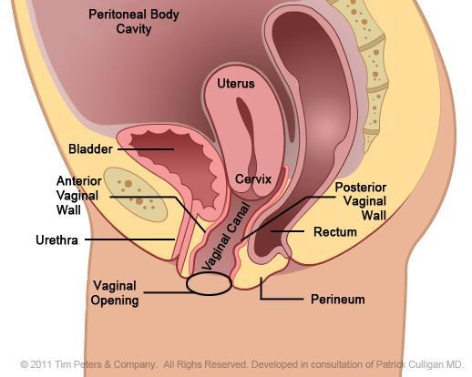 Definição - descida de uma ou mais porções a seguir: Parede vaginal anterior