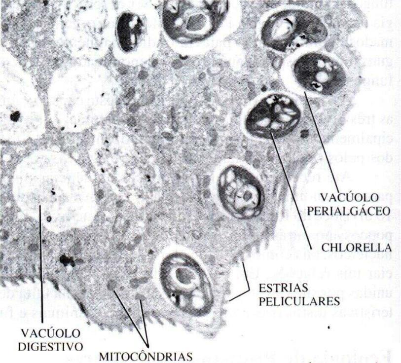 Vorticella com