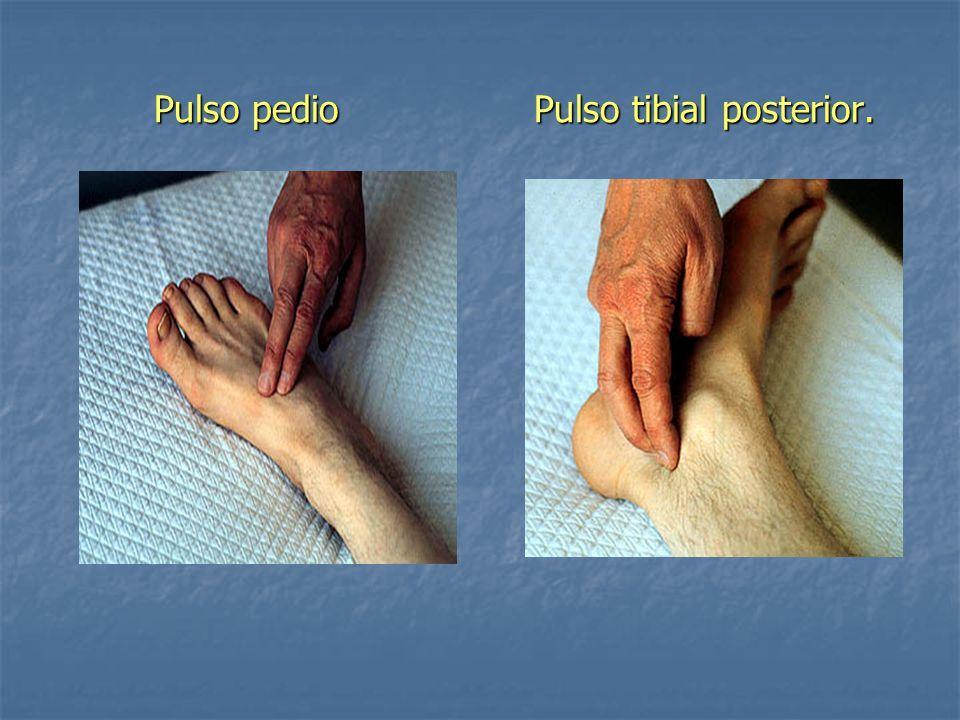 Exame vascular: ( ) pêlos reduzidos no dorso do pé e pernas ( )