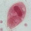 MORFOLOGIA São ciliados ovais com fileiras de cílios longitudinais, revestindo todo o corpo. É o maior protozoário parasito do homem.