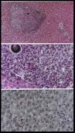 istologia do fígado após tratamento
