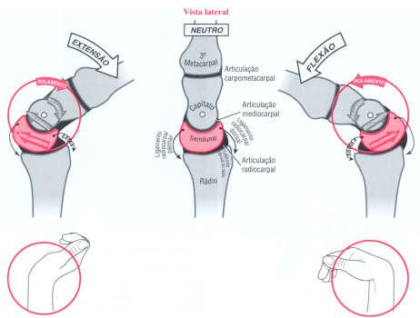 pseudoartose