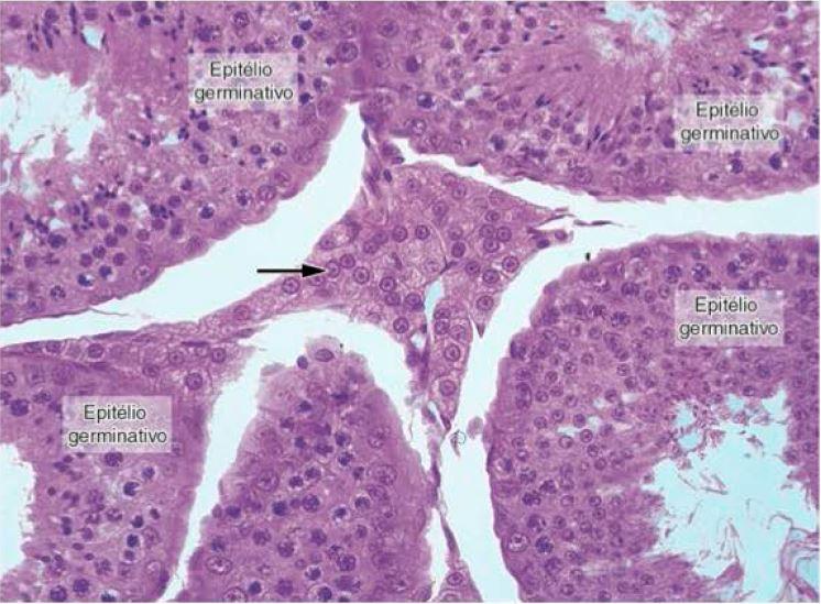 Células de Leydig Túbulos seminíferos Agrupamento