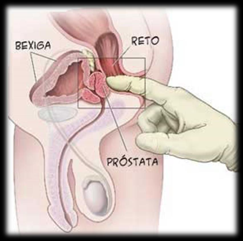 Examinando o reto e o ânus O reto e o canal anal constituem os últimos segmentos do aparelho gastrointestinal.