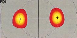 The corticomotor