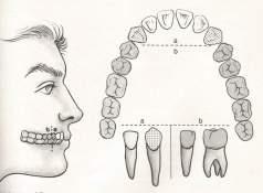 caninos, 8 pré-molares e 12 molares. Os incisivos, caninos e pré-molares nascem no lugar de um dente decíduo que caiu.