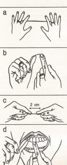 Como utilizar o fio dental? Pegue um pedaço de fio dental de 25 a 45 centímetros. Enrole em torno do dedos médios das mãos (FIG.20-a). Depois, segure com os dedos indicadores (FIG.