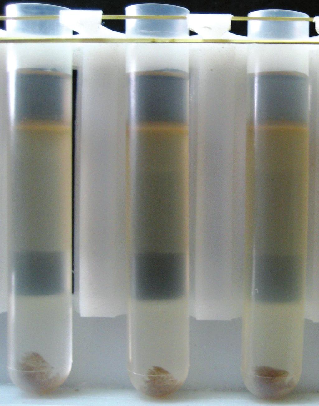 From top to bottom can be identified: a sucrose band, a soft dirty ring, a baculovirus band and a sucrose plus buffer band. Gross dirt precipitate can be observed at the bottom of the tubes.