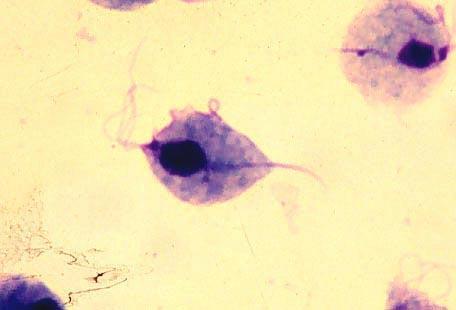 cruzi Giardia