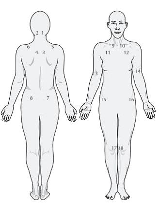 pontos tem sido importante no caso da fibromialgia, pois se comparados a pessoas não acometidas com a doença, estes pontos ao serem pressionados em pessoas sadias apresentam uma intensidade de dor