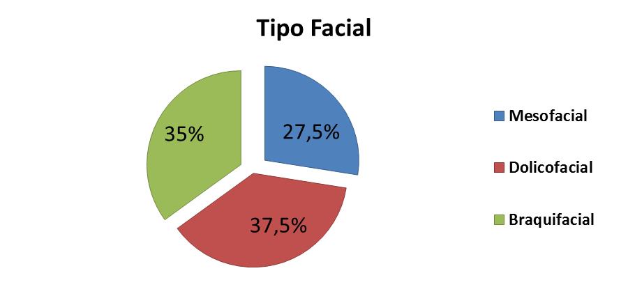 20 Com relação aos modelos dos 40 analisados de acordo com a classificação de Angle notamos a presença de 22 pacientes com má oclusão de classe I, representando assim 55% da amostra; 11 pacientes com