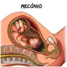 O feto engole líquido amniótico que contém todos os outros componentes mencionados acima.