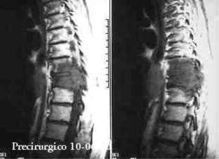 Porém recomendamos a NÃO misturar componentes de fabricantes distintos por razões de incompatibilidade metalúrgica, mecânica, dimensional e de projeto.