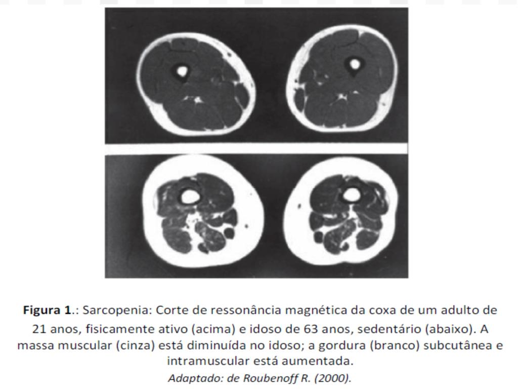 A massa muscular é resultante do equilíbrio entre a síntese (anabolismo) e destruição (catabolismo) das suas proteínas, principalmente as mio brilares.