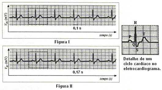 5) Os cardiomiócitos são células altamente diferenciadas e logo após os primeiros anos de vida param de se multiplicar, desta forma, o crescimento do coração é consequência da hipertrofia (aumento no