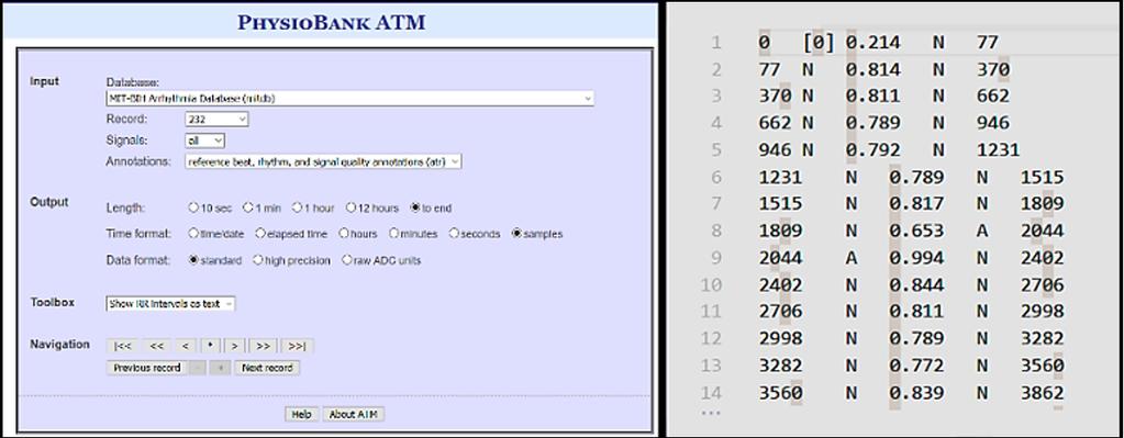 A Figura 9 mostra a interface de geração das anotações da Physionet e um exemplo de um arquivo gerado.