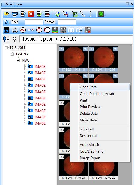 Também pode fazer uma selecção de imagens (ctrl + botão esquerdo do rato) e usar o botão abrir dados ou