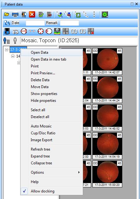 NOTA para fechar a janela de dados do paciente depois de abrir as imagens ou dados, seleccione em opções