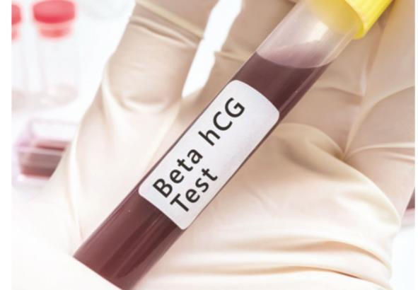 Diagnóstico de Gravidez: Dosagem de gonadotrofina coriônica humana (ßHCG) - detectado no sangue periférico
